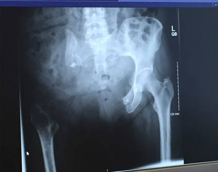 Janes Xray