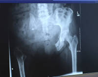 Janes Xray Thumbnail